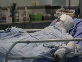  مرگ ۵۲ نفر در آذربایجان‌شرقی بر اثر سوختگی