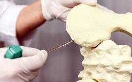 تبریز دومین قطب پیوند مغز استخوان نیمه‌سازگار در ایران
