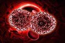 پزشکی سامانه‌ای: انقلابی در درمان سرطان خون