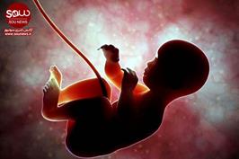 دلایل اصلی سقط های عمدی چیست؟